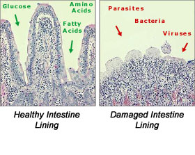 Healthy Mucosal Intestine Lining vs. Unhealthy Mucosal Intestine Lining